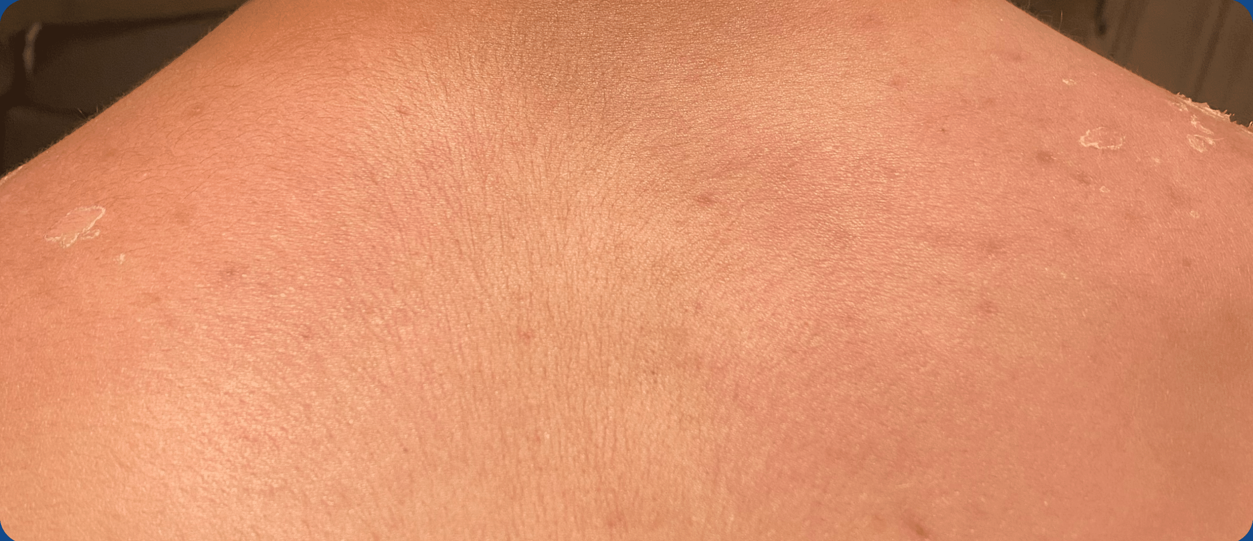 After Image: Clear Cell Skinscare - back