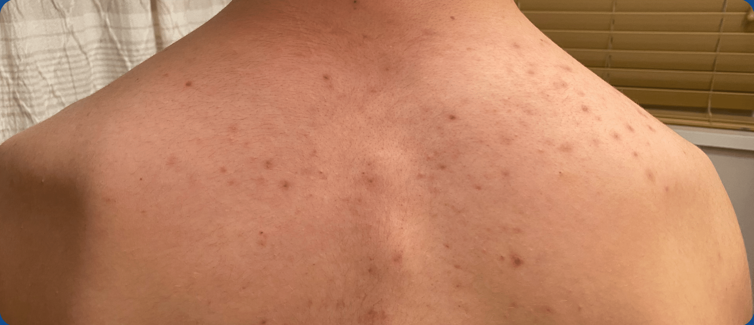 Before Image: Clear Cell Skinscare - back