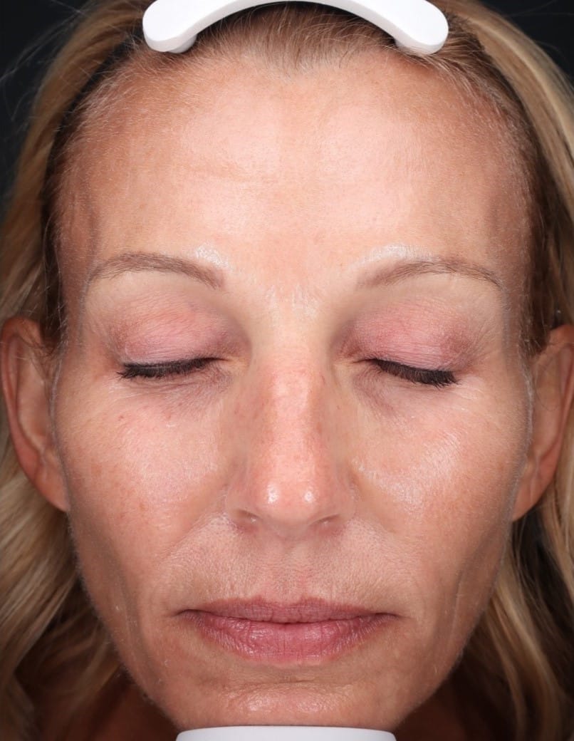 Before Image: Halo - front