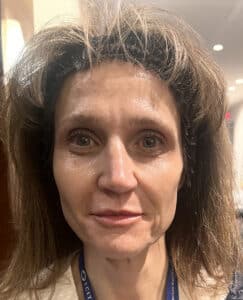 Before Image: Halo