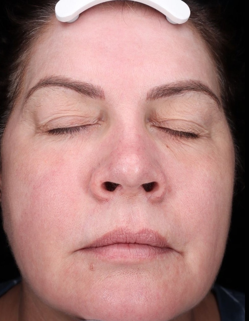 After Image: Moxi - front