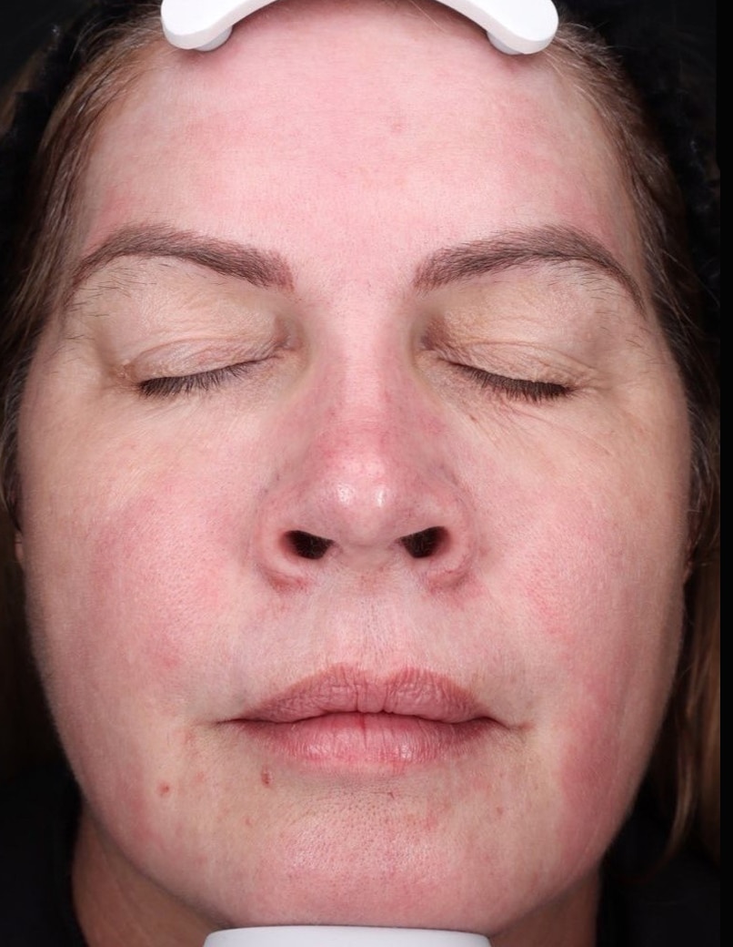 Before Image: Moxi - front