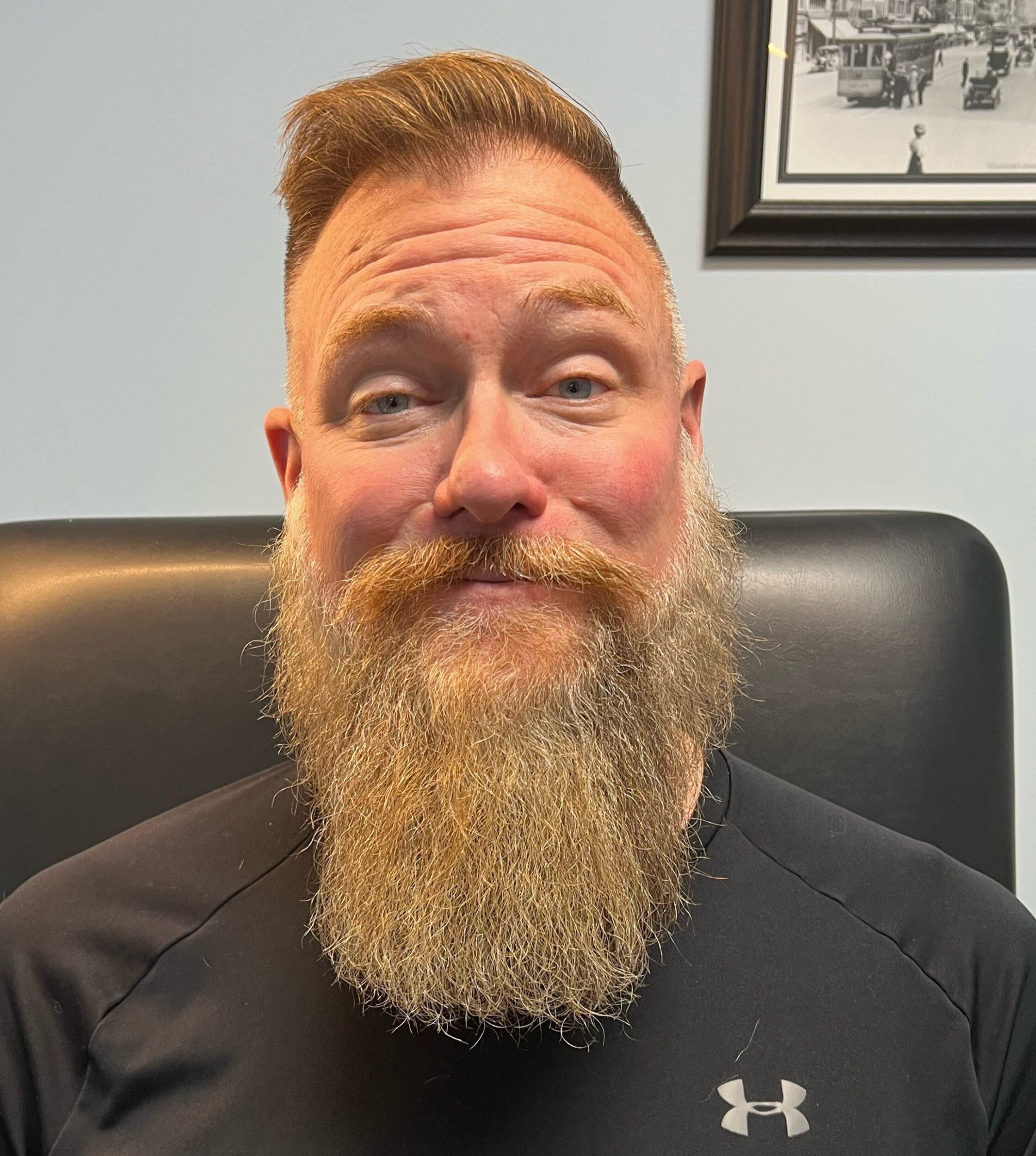 Before Image: Botox - front