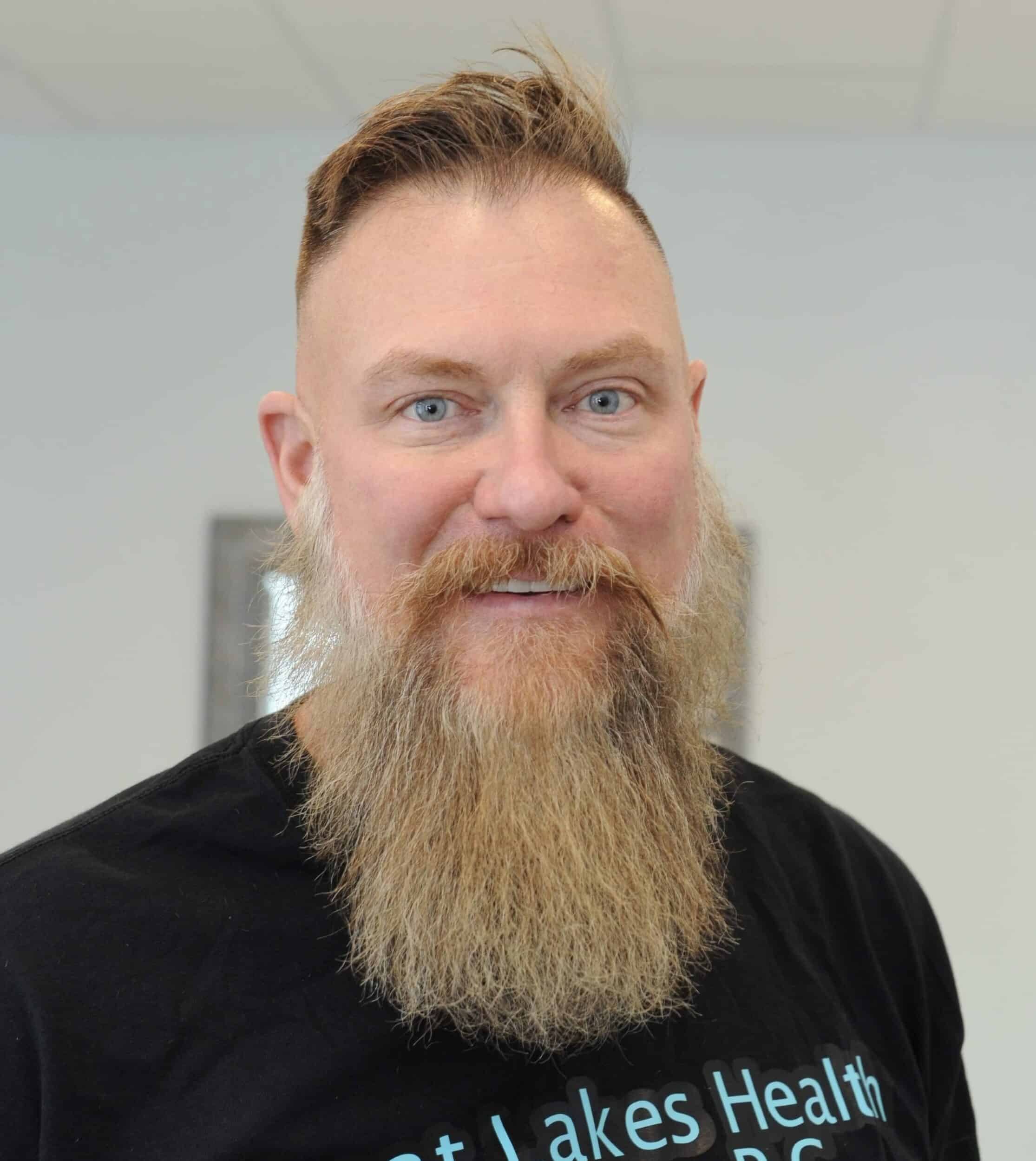 After Image: Botox - front