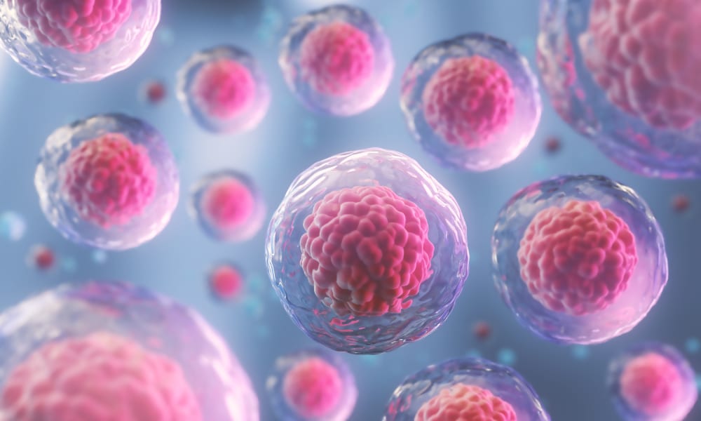 Exosomes Treatment Downriver MI