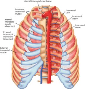 dystonion posterior intercostal nerve injections