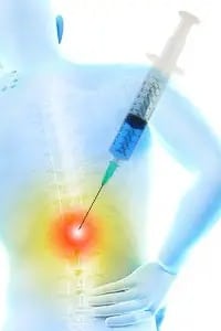 dystonion posterior Back Pain injections