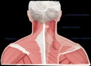 dystonion posterior dystonion posterior